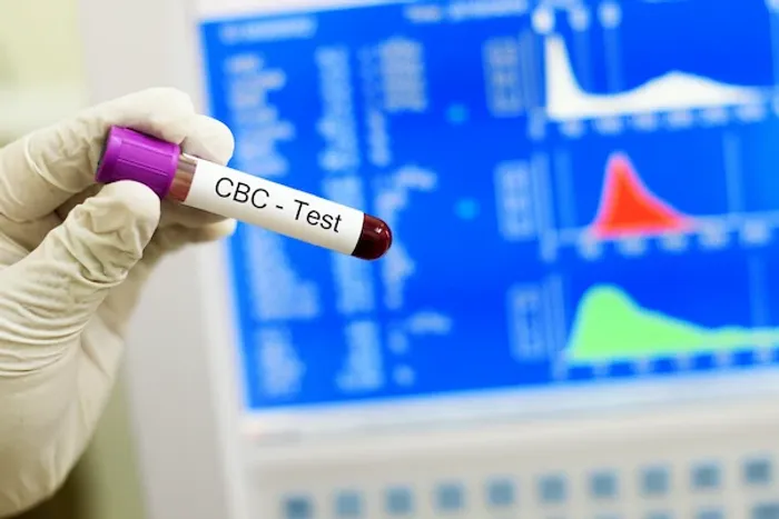 CBC FOR FEVER